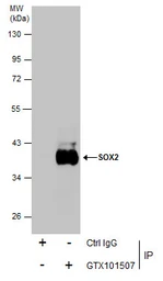 Anti-SOX2 antibody [N1C3] used in Immunoprecipitation (IP). GTX101507
