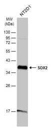 Anti-SOX2 antibody [N1C3] used in Western Blot (WB). GTX101507