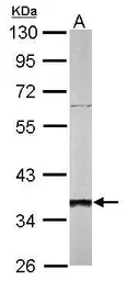 Anti-SGTA antibody used in Western Blot (WB). GTX101532