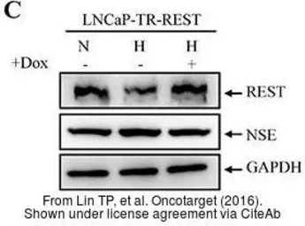 Anti-NSE antibody [N1C1] used in Western Blot (WB). GTX101553
