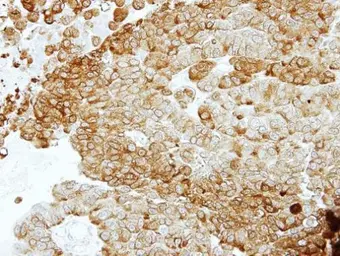 Anti-NSE antibody [N1C1] used in IHC (Paraffin sections) (IHC-P). GTX101553