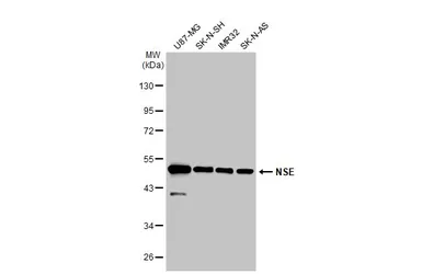 Anti-NSE antibody [N1C1] used in Western Blot (WB). GTX101553