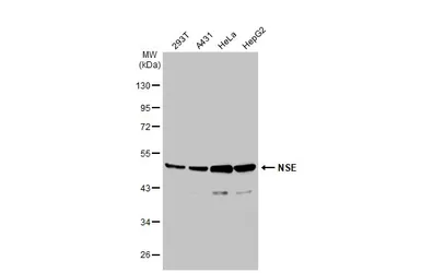 Anti-NSE antibody [N1C1] used in Western Blot (WB). GTX101553