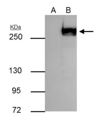 Anti-mTOR antibody [C3], C-term used in Immunoprecipitation (IP). GTX101557