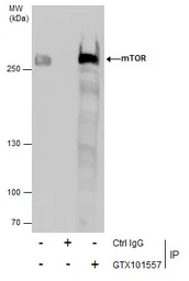 Anti-mTOR antibody [C3], C-term used in Immunoprecipitation (IP). GTX101557