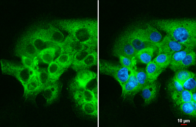 Anti-mTOR antibody [C3], C-term used in Immunocytochemistry/ Immunofluorescence (ICC/IF). GTX101557