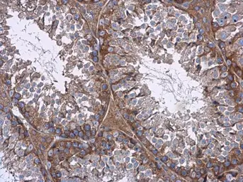 Anti-mTOR antibody [C3], C-term used in IHC (Paraffin sections) (IHC-P). GTX101557