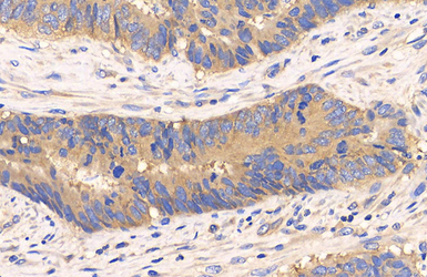 Anti-mTOR antibody [C3], C-term used in IHC (Paraffin sections) (IHC-P). GTX101557