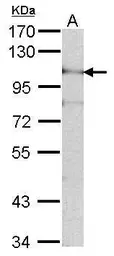 Anti-ADAM15 antibody [N1N2], N-term used in Western Blot (WB). GTX101599