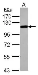 Anti-alpha Adducin antibody used in Western Blot (WB). GTX101600