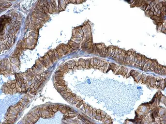 Anti-alpha Adducin antibody used in IHC (Paraffin sections) (IHC-P). GTX101600