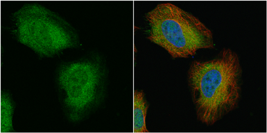 Anti-Transgelin antibody used in Immunocytochemistry/ Immunofluorescence (ICC/IF). GTX101608