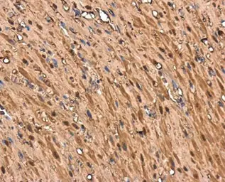 Anti-Transgelin antibody used in IHC (Paraffin sections) (IHC-P). GTX101608