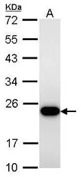 Anti-Transgelin antibody used in Western Blot (WB). GTX101608