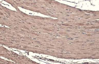 Anti-Transgelin antibody used in IHC (Paraffin sections) (IHC-P). GTX101608