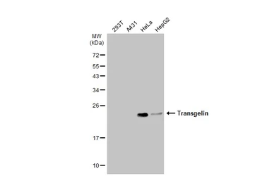 Anti-Transgelin antibody used in Western Blot (WB). GTX101608
