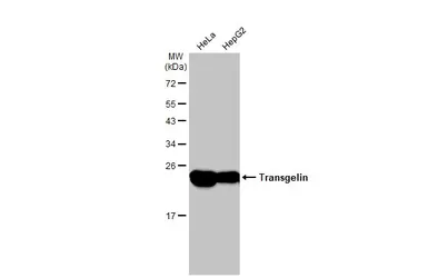 Anti-Transgelin antibody used in Western Blot (WB). GTX101608
