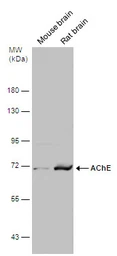 Anti-AChE antibody used in Western Blot (WB). GTX101648