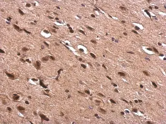 Anti-AChE antibody used in IHC (Paraffin sections) (IHC-P). GTX101648