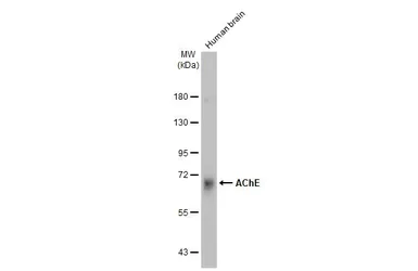 Anti-AChE antibody used in Western Blot (WB). GTX101648