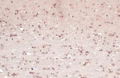 Anti-AChE antibody used in IHC (Paraffin sections) (IHC-P). GTX101648