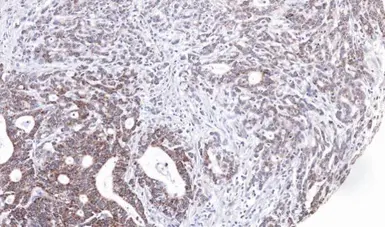 Anti-UBE2M antibody [N1C2] used in IHC (Paraffin sections) (IHC-P). GTX101653