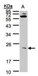 Anti-UBE2M antibody [N1C2] used in Western Blot (WB). GTX101653