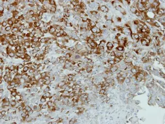 Anti-alpha Actinin 4 antibody [C2C3], C-term used in IHC (Paraffin sections) (IHC-P). GTX101669