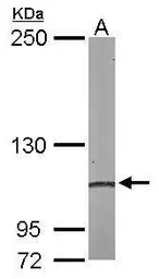 Anti-alpha Actinin 4 antibody [C2C3], C-term used in Western Blot (WB). GTX101669