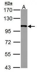 Anti-alpha Actinin 4 antibody [C2C3], C-term used in Western Blot (WB). GTX101669