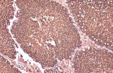 Anti-Calnexin antibody [N3C2], Internal used in IHC (Paraffin sections) (IHC-P). GTX101676