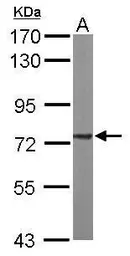 Anti-SDHA antibody used in Western Blot (WB). GTX101689