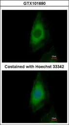 Anti-PP2A beta antibody used in Immunocytochemistry/ Immunofluorescence (ICC/IF). GTX101690