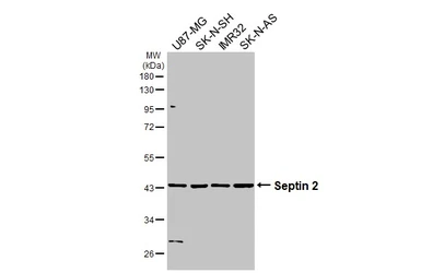 Anti-Septin 2 antibody [N1N3] used in Western Blot (WB). GTX101693