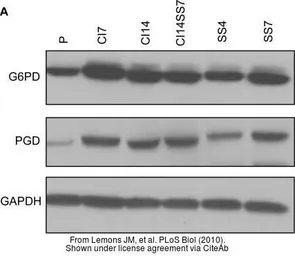 Anti-PGD antibody [N1N3] used in Western Blot (WB). GTX101703