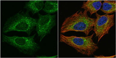 Anti-PGD antibody [N1N3] used in Immunocytochemistry/ Immunofluorescence (ICC/IF). GTX101703