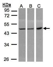 Anti-PGD antibody [N1N3] used in Western Blot (WB). GTX101703