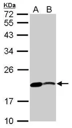 Anti-nm23-H2 antibody used in Western Blot (WB). GTX101706