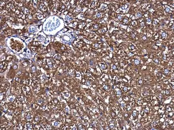 Anti-Ferritin Heavy Chain antibody [N1C3] used in IHC (Paraffin sections) (IHC-P). GTX101733
