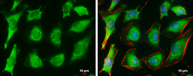 Anti-Ferritin Heavy Chain antibody [N1C3] used in Immunocytochemistry/ Immunofluorescence (ICC/IF). GTX101733