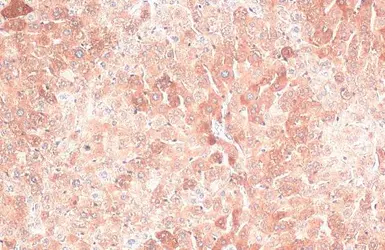 Anti-Ferritin Heavy Chain antibody [N1C3] used in IHC (Paraffin sections) (IHC-P). GTX101733
