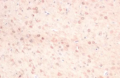 Anti-Ferritin Heavy Chain antibody [N1C3] used in IHC (Paraffin sections) (IHC-P). GTX101733