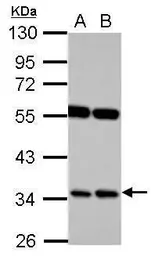 Anti-RASSF7 antibody used in Western Blot (WB). GTX101740