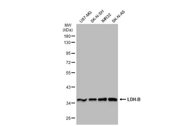 Anti-LDH-B antibody used in Western Blot (WB). GTX101747