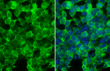 Anti-Creatine kinase (brain) antibody [N1C1] used in Immunocytochemistry/ Immunofluorescence (ICC/IF). GTX101759