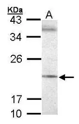 Anti-Sec61 gamma subunit antibody used in Western Blot (WB). GTX101782