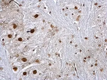 Anti-hnRNP K antibody used in IHC (Paraffin sections) (IHC-P). GTX101786