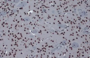 Anti-hnRNP K antibody used in IHC (Paraffin sections) (IHC-P). GTX101786