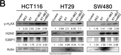Anti-Actin Gamma 1 antibody used in Western Blot (WB). GTX101794
