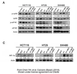 Anti-Actin Gamma 1 antibody used in Western Blot (WB). GTX101794
